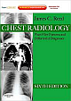 Chest Radiology: Plain Film Patterns and Differential Diagnoses [With Access Code] 6 Edition