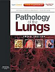Pathology Of The Lungs, 3/E