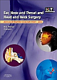 Ear, Nose and Throat and Head and Neck Surgery: An Illustrated Colour Text, 4e