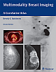 Multimodality Breast Imaging: A Correlative Atlas 2nd Edition
