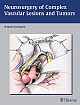 Neurosurgery of Complex Vascular Lesions and Tumors