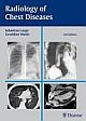 Radiology of Chest Diseases 3rd Edition
