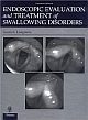 Endoscopic Evaluation And Treatment Of Swallowing Disorders