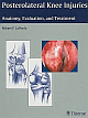  Posterolateral Knee Injuries: Anatomy, Evaluation, and Treatment