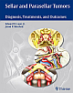 Sellar and Parasellar Tumors: Diagnosis, Treatments, and Outcomes