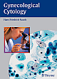 Gynecologic Cytology 