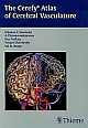 The Cerefy Atlas of Cerebral Vasculature/CD-ROM 1 Cdr Edition 