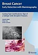 Casting Type Calcifications: Sign of a Subtype With Unpredictable Outcome (Breast Cancer - Early Detection with Mammography) (v. 2)