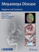 Moyamoya Disease: Diagnosis And Treatment (Hb 2014)