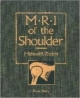 M. R .I  Of The Shoulder