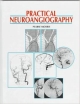 Practical Neuroangiography