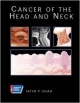 Cancer Of The Head & Neck: A Volume In The American Cancer Society Atlas Of Clinical Oncology Series