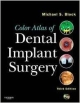 Color Atlas Of Dental Implant Surgery, 3E