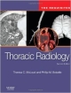 Thoracic Radiology: The Requisites, 2E