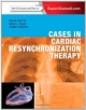 Cases In Cardiac Resynchronization Therapy (Pb 2014)