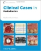 Clinical Cases In Periodontics (Pb 2012)