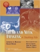 Head & Neck Imaging 2Ed: A Teaching File (Hb)