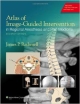 Atlas Of Image Guided Intervention In Regional Anesthesia & Pain Medicine 2Ed (Hb)