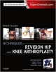 Techniques In Revision Hip And Knee Arthroplasty (Hb 2014)