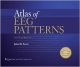 Atlas Of Eeg Patterns 2Ed (Hb 2013)