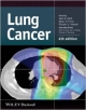 Lung Cancer 4Ed (Hb 2014)