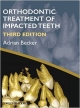 Orthodontic Treatment Of Impacted Teeth 3Ed (Hb 2012)