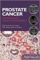 Prostate Cancer: Diagnosis And Clinical Management (Pb 2014)