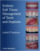 Esthetic Soft Tissue Management Of Teeth And Implants (Hb)