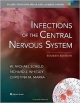 Infections Of The Central Nervous System 4Ed (Hb 2014)