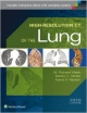 High-Resolution Ct Of The Lung 5Ed (Hb 2015)