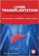 Liver Transplantation: Clinical Assessment And Management (Hb 2013)