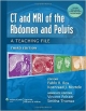 Ct & Mri Of The Abdomen And Pelvis: A Teaching File 3Ed (Pb 2014)