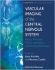Vascular Imaging Of The Central Nervous System: Physical Principles, Clinical Applications And Emerging Techniques (Hb 2014)