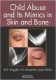 Child Abuse And Its Mimics In Skin And Bone (Hb 2013)
