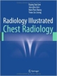 Radiology Illustrated: Chest Radiology  (Hb 2014)