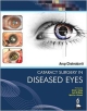 CATARACT SURGERY IN DISEASED EYES