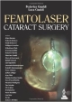 FEMTOLASER CATARACT SURGERY