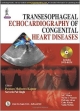 TRANSESOPHAGEAL ECHOCARDIOGRAPHY OF CONGENITAL HEART DISEASES