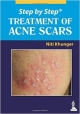 STEP BY STEP TREATMENT OF ACNE SCARS