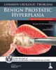 Common Urologic Problems Benign Prostatic Hyperplasia
