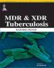 MDR and XDR Tuberculosis 