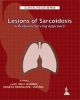 Clinical Focus Series: Lesions of Sarcoidosis-A Problem Solving Approach 