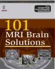 101 MRI Brain Solutions 