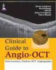 Clinical Guide to Angio-OCT (Non Invasive, Dyeless OCT Angiography) 