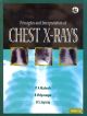 Principles and Interpretation of Chest X-rays(with CD)
