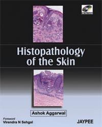 Histopathology of the Skin with Photo CDROM