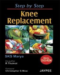 Step by Step Knee Replanement, 2007 with DVD