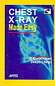 Chest X-Ray Made Easy (With Photo CD-ROM) 1st Edition