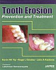 Tooth Erosion Prevention and Treatment 1st Edition