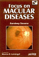 Focus on Macular Diseases DVD-rom 2007